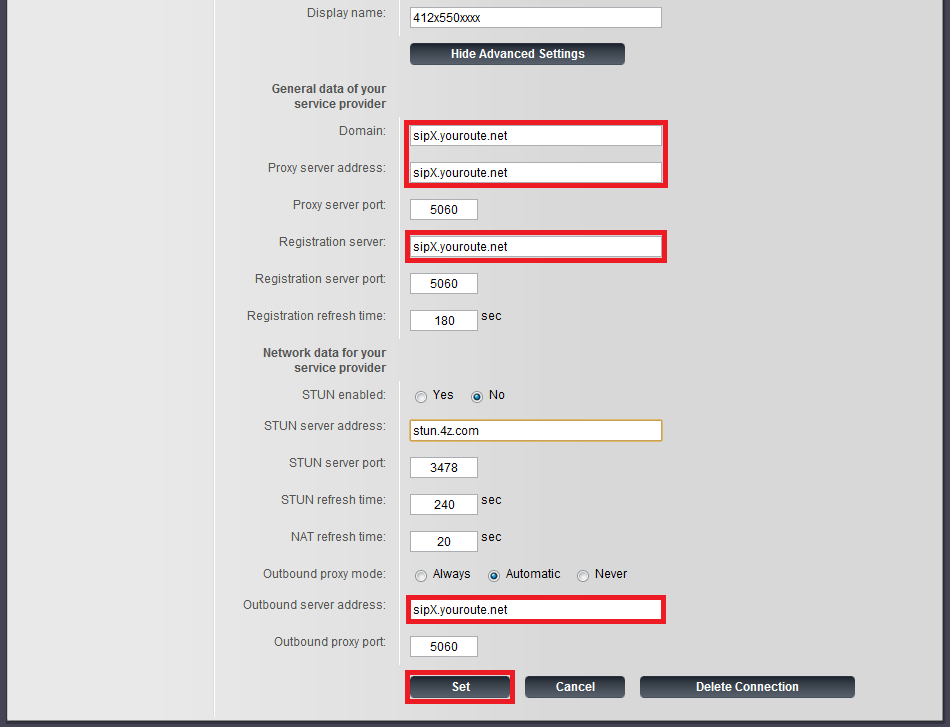 A510IP Telephony Advance Settings